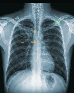 X-Ray Machine in use